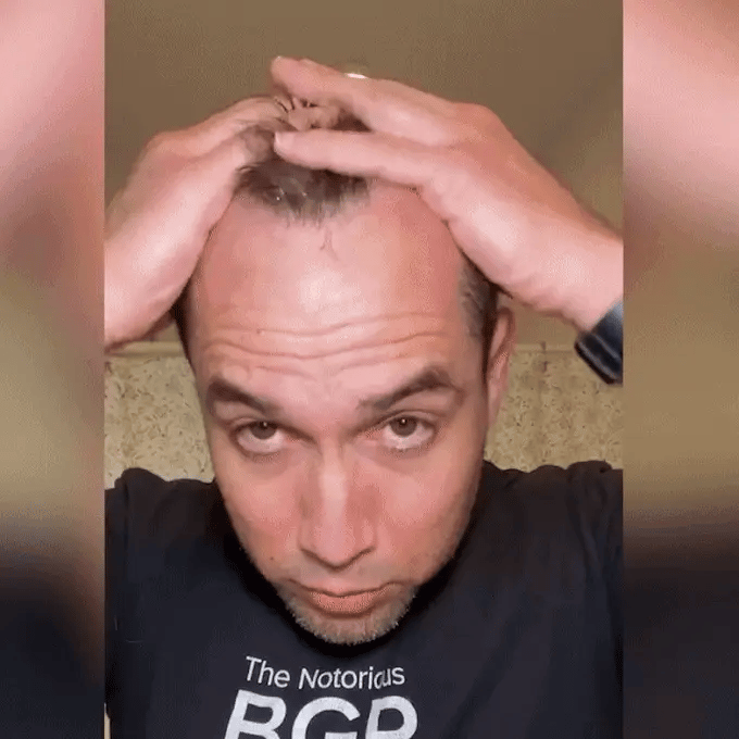FEG Hair Growth Spray
